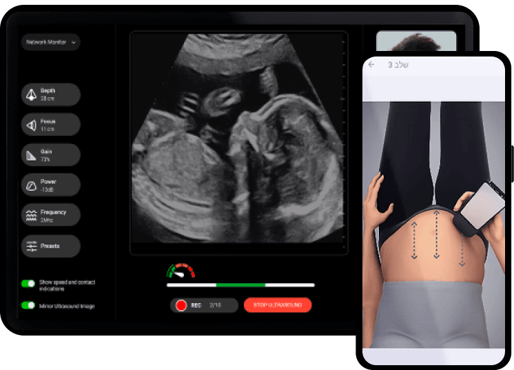 Mobile application for pregnancy monitoring